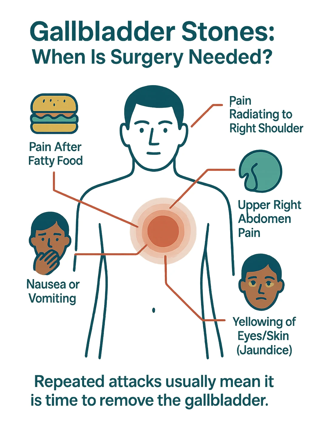 Gallbladder stones symptoms infographic