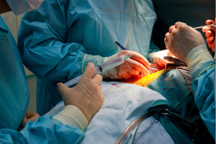 Thoracic Surgery