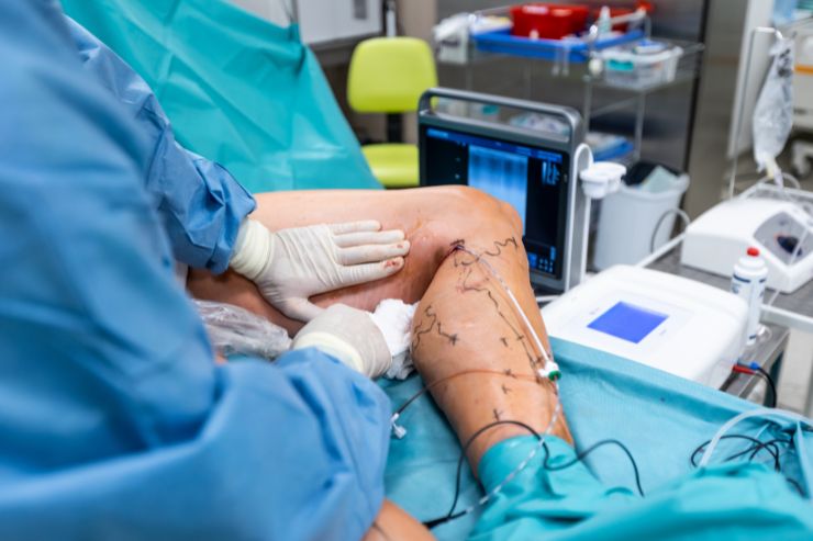 Vascular Surgery